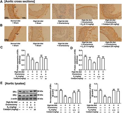 Catalpol Inhibits Macrophage Polarization and Prevents Postmenopausal Atherosclerosis Through Regulating Estrogen Receptor Alpha